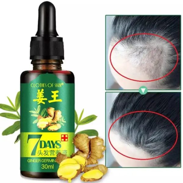 7 Days Hair Growth Germinal Serum Oil for Men & Women's